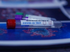 "Можно ли сдать тест на коронавирус?" - морозовчанам ответили в Центре мониторинга и в администрации района 