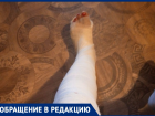 Из-за отсутствия освещения жительница Морозовска сломала ногу в двух местах 