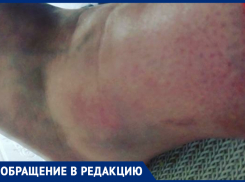 Морозовчанка повредила себе ногу, споткнувшись на неровном тротуаре 