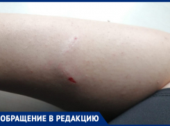 Женщину искусала стая бездомных собак в центре Морозовска