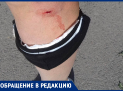 Собака укусила морозовчанку прямо на рынке