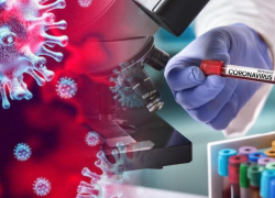 25 августа: ещё 7 случаев COVID-19 выявили за сутки в Морозовском районе 