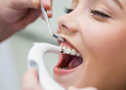 Ищешь, где делают профессиональную чистку зубов? Посмотри в Справочнике