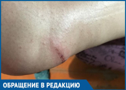 Возвращаясь вечером домой по Пламя Революции, чуть не сломала ногу, - морозовчанка 