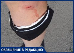Собака укусила морозовчанку прямо на рынке