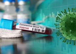 8 октября: еще шесть случаев COVID-19 подтвердили за сутки в Морозовском районе