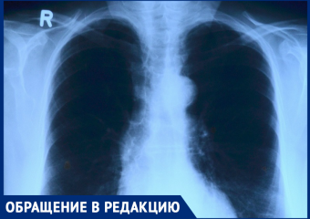Почему нельзя сделать отдельные часы выдачи результатов? - морозовчанка об очередях в рентген-кабинет