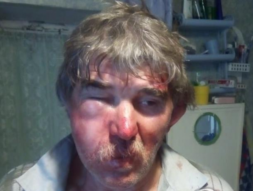 Мужчину избили в Морозовске после парковки автомобиля у частного двора