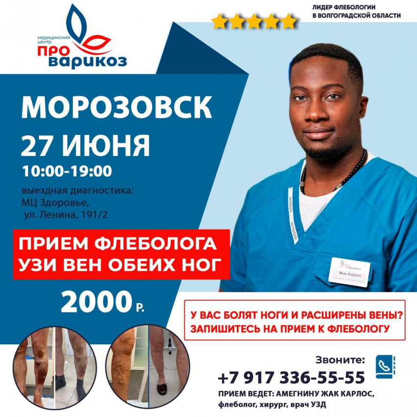 Прием флеболога в Морозовске состоится 27 июня